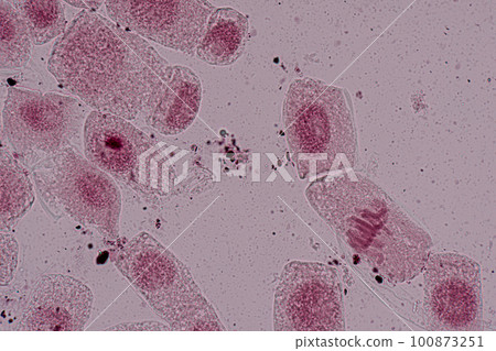 Root tip of Onion and Mitosis cell in the Root tip of Onion under a microscope. Root tip of Onion and Mitosis cell in the Root tip of Onion under a microscope. 100873251