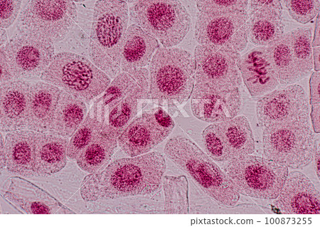 Root tip of Onion and Mitosis cell in the Root tip of Onion under a microscope. Root tip of Onion and Mitosis cell in the Root tip of Onion under a microscope. 100873255