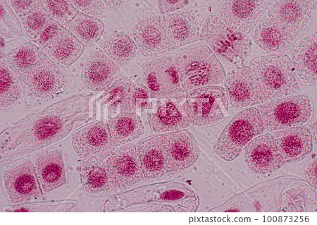 Root tip of Onion and Mitosis cell in the Root tip of Onion under a microscope. Root tip of Onion and Mitosis cell in the Root tip of Onion under a microscope. 100873256