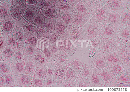 Root tip of Onion and Mitosis cell in the Root tip of Onion under a microscope. 100873258