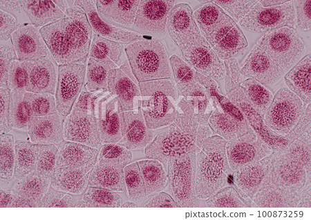 Root tip of Onion and Mitosis cell in the Root tip of Onion under a microscope. Root tip of Onion and Mitosis cell in the Root tip of Onion under a microscope. 100873259