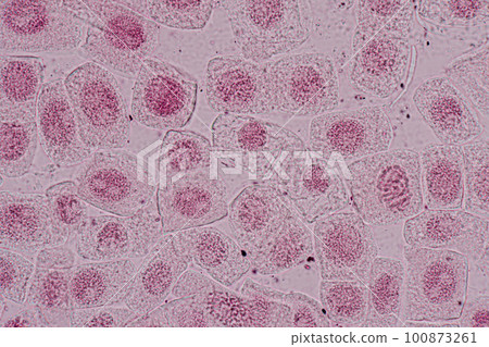 Root tip of Onion and Mitosis cell in the Root tip of Onion under a microscope. Root tip of Onion and Mitosis cell in the Root tip of Onion under a microscope. 100873261