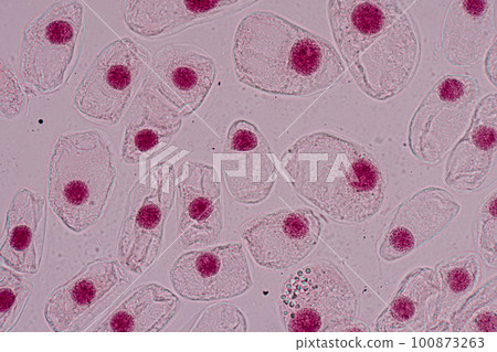 Root tip of Onion and Mitosis cell in the Root tip of Onion under a microscope. Root tip of Onion and Mitosis cell in the Root tip of Onion under a microscope. 100873263