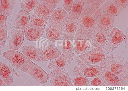 Root tip of Onion and Mitosis cell in the Root tip of Onion under a microscope. 100873264