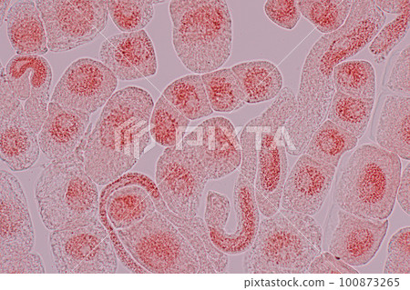 Root tip of Onion and Mitosis cell in the Root tip of Onion under a microscope. Root tip of Onion and Mitosis cell in the Root tip of Onion under a microscope. 100873265