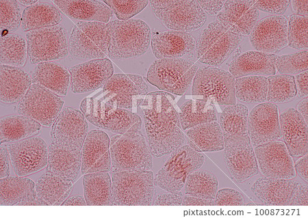 Root tip of Onion and Mitosis cell in the Root tip of Onion under a microscope. Root tip of Onion and Mitosis cell in the Root tip of Onion under a microscope. 100873271