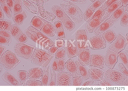 Root tip of Onion and Mitosis cell in the Root tip of Onion under a microscope. Root tip of Onion and Mitosis cell in the Root tip of Onion under a microscope. 100873275