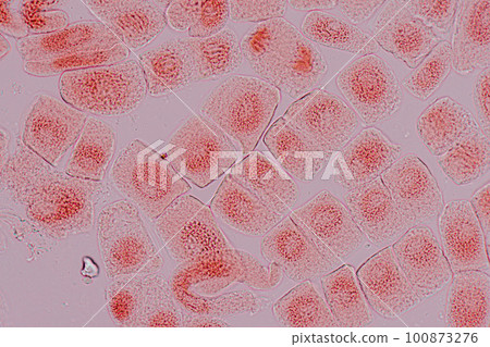 Root tip of Onion and Mitosis cell in the Root tip of Onion under a microscope. Root tip of Onion and Mitosis cell in the Root tip of Onion under a microscope. 100873276
