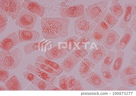 Root tip of Onion and Mitosis cell in the Root tip of Onion under a microscope. 100873277