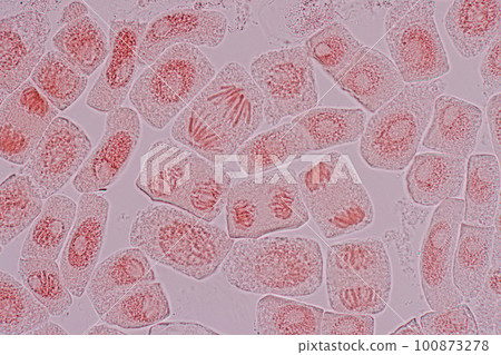 Root tip of Onion and Mitosis cell in the Root tip of Onion under a microscope. 100873278