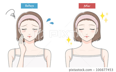 A woman who suffers from dark circles before and after closing her eyes 100877453