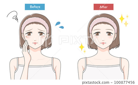 A woman suffering from blemishes before and after 100877456