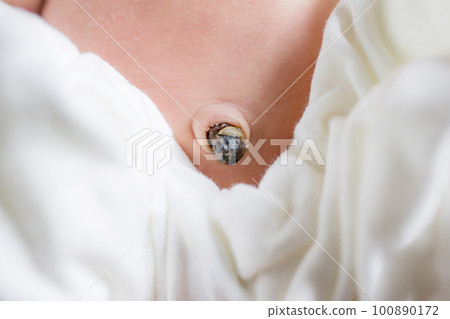 寶寶的臍帶 100890172