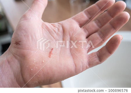 A cut on a man's palm in close-up. Household skin damage with a sharp cutting object, first aid 100896576