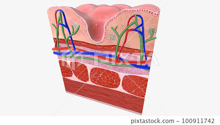 Celiac Disease is a chronic condition characterized an inflammatory allergic response of the digestive tract to Gluten. Celiac Disease is a chronic condition characterized an inflammatory allergic response of the digestive tract to Gluten. 100911742