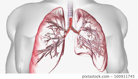 Cystic fibrosis is a genetically inherited disease that affects secretory cells throughout the body. 100911745