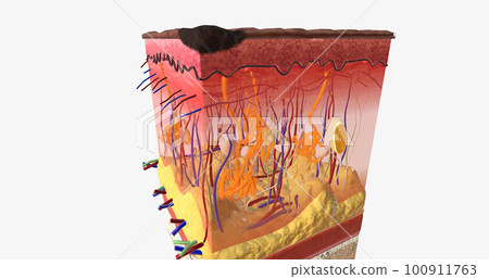 In Stage I ALM, the tumor is very small and located on the top-most layer of the skin, the epidermis. In Stage I ALM, the tumor is very small and located on the top-most layer of the skin, the epidermis. 100911763