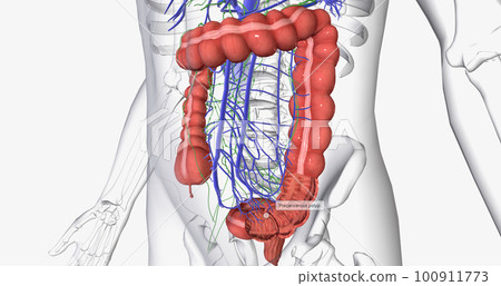 Colorectal cancer (CRC) is a common colon or rectal cancer that affects many patients over middle age. 100911773