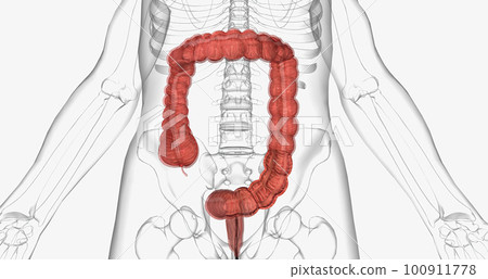 Colonoscopy is an invasive procedure used to look inside the large intestines. 100911778