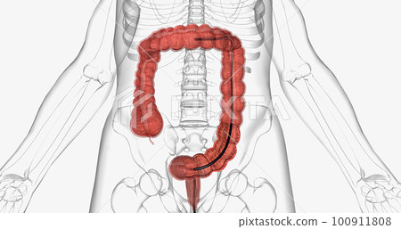 Colonoscopy is an invasive procedure used to look inside the large intestines. Colonoscopy is an invasive procedure used to look inside the large intestines. 100911808