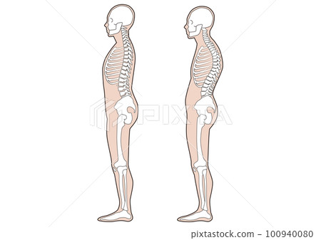 人體，人體骨骼，好姿勢，壞姿勢，身體變形 100940080