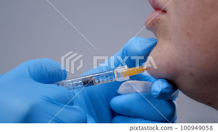A doctor inserts painkillers into the chin area of womans face 100949058