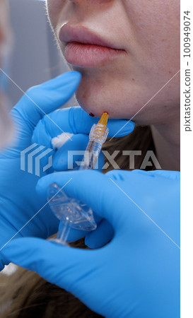 A doctor inserts painkillers into the chin area of womans face A doctor inserts painkillers into the chin area of womans face 100949074
