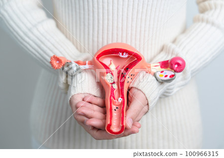 Woman holding Uterus and Ovaries model. Ovarian and Cervical cancer, Cervix disorder, Endometriosis, Hysterectomy, Uterine fibroids, Reproductive system and Pregnancy concept Woman holding Uterus and Ovaries model. Ovarian and Cervical cancer, Cervix disorder, Endometriosis, Hysterectomy, Uterine fibroids, Reproductive system and Pregnancy concept 100966315