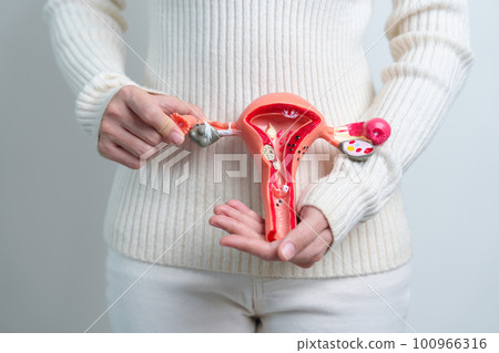 Woman holding Uterus and Ovaries model. Ovarian and Cervical cancer, Cervix disorder, Endometriosis, Hysterectomy, Uterine fibroids, Reproductive system and Pregnancy concept Woman holding Uterus and Ovaries model. Ovarian and Cervical cancer, Cervix disorder, Endometriosis, Hysterectomy, Uterine fibroids, Reproductive system and Pregnancy concept 100966316