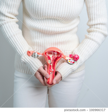 Woman holding Uterus and Ovaries model. Ovarian and Cervical cancer, Cervix disorder, Endometriosis, Hysterectomy, Uterine fibroids, Reproductive system and Pregnancy concept 100966317