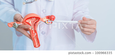 Doctor holding Uterus and Ovaries model. Ovarian and Cervical cancer, Cervix disorder, Endometriosis, Hysterectomy, Uterine fibroids, Reproductive system and Pregnancy concept Doctor holding Uterus and Ovaries model. Ovarian and Cervical cancer, Cervix disorder, Endometriosis, Hysterectomy, Uterine fibroids, Reproductive system and Pregnancy concept 100966335