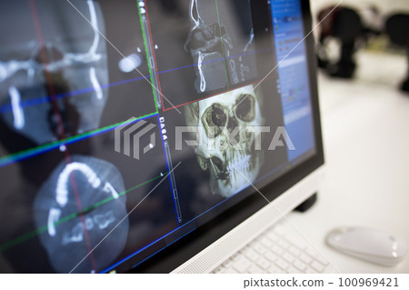 The male hand of the dentist on the monitor screen shows the jaw. The male hand of the dentist on the monitor screen shows the jaw. 100969421