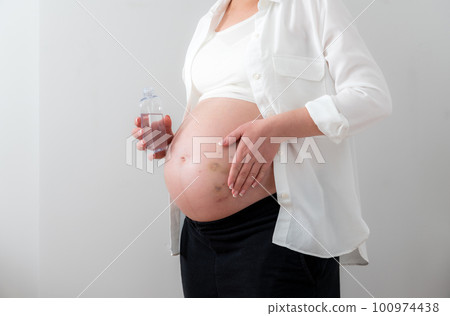 Pregnant woman applying cosmetic oil on her belly for healing puncture marks, bruises and stretches 100974438