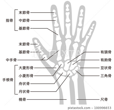 Hand skeleton medical injury human body model Hand skeleton medical injury human body model 100996653