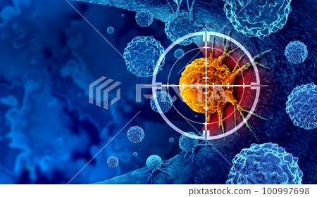 Cancer Detection 100997698