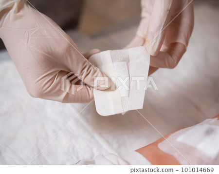 Close-up of the replacement of a sterile patch by a nurse with a glove on a patient's knee after surgery Close-up of the replacement of a sterile patch by a nurse with a glove on a patient's knee after surgery 101014669