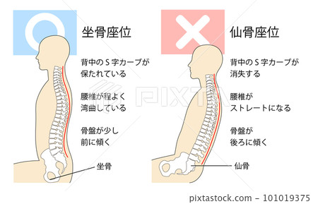 坐骨坐姿與坐骨坐姿對比圖解 坐骨坐姿與坐骨坐姿對比圖解 101019375