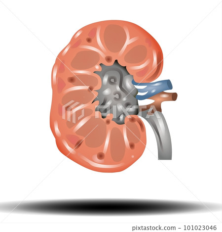 Kidney - internal organ, Kidney stones. Renal calculi, nephrolithiasis or urolithiasis. Healthcare concept, vector illustration on white background Kidney - internal organ, Kidney stones. Renal calculi, nephrolithiasis or urolithiasis. Healthcare concept, vector illustration on white background 101023046