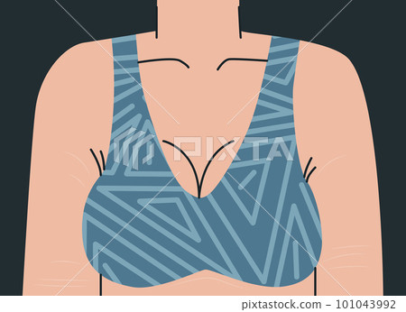 Big female bust in bra. Woman's body with stretch marks on her arms and chest. Upper female body in geometric print top. Vector trend illustration for design. 101043992