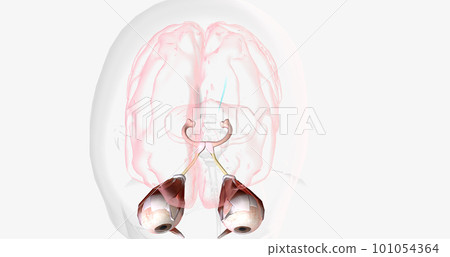 Strabismic Amblyopia, Visual Pathway with Eye Movement Strabismic Amblyopia, Visual Pathway with Eye Movement 101054364