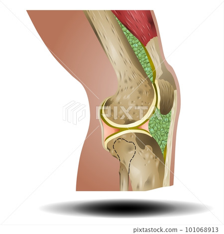 Bones Pain, Injury and Inflammation, Knee Joint Pain Silhouette Icon Ache of Knee, Leg Skeleton, Arthritis, Osteoporosis and Bones Joint, Illustration 101068913