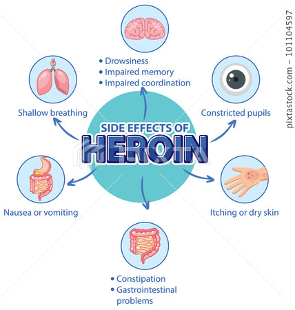 Human anatomy diagram cartoon style of Heroin - Stock Illustration  [101104597] - PIXTA