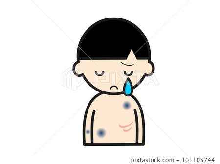 有傷疤的男孩 101105744