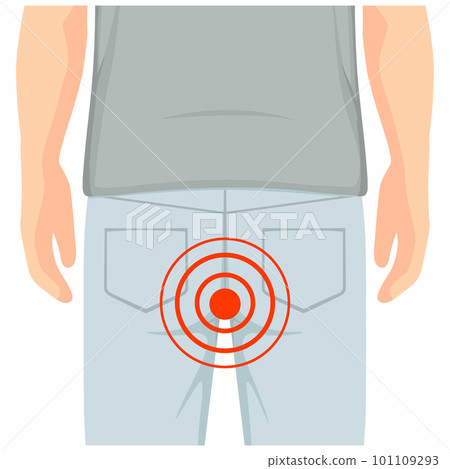 suffers from hemorrhoids.health problems. Healthcare concept. Vector illustration 101109293