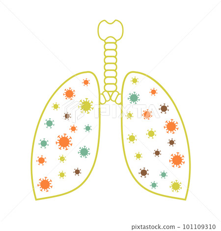 Coronavirus attacks human lungs and causes pneumonia. Lung infection - covid-19, vcov 2019. Microscope virus close up 101109310