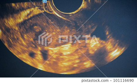Utrasound image on the monitor close-up. Ultrasound Scan display. Screening Ultrasonography Analysis of person. Ultrasound examination Using Scanner. Ultrasound Scan Device. Echocardiography 101116690