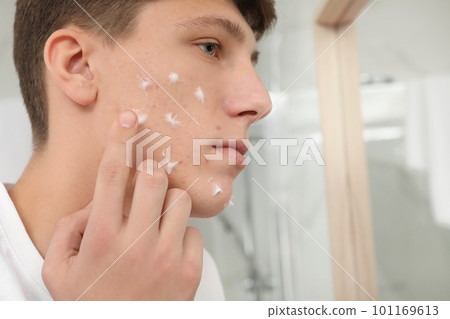 Teen guy with acne problem applying cream in bathroom, closeup Teen guy with acne problem applying cream in bathroom, closeup 101169613