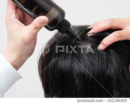 Back view of a man who applies a hair restorer to his hair / scalp care Back view of a man who applies a hair restorer to his hair / scalp care 101196920