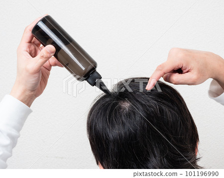 將生髮劑應用於頭髮/頭皮護理的男士的後視圖 101196990