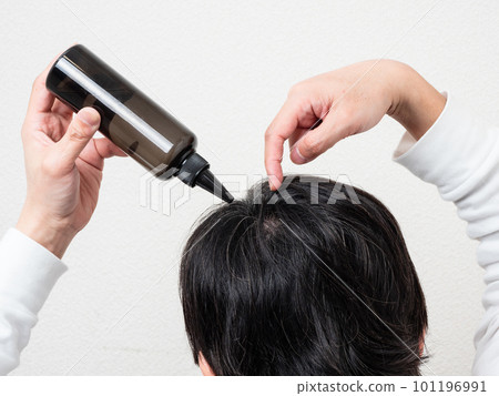 將生髮劑應用於頭髮/頭皮護理的男士的後視圖 101196991